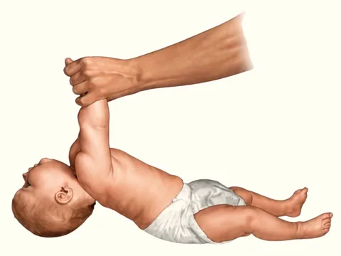 Ilustración: un adulto incorpora a un bebé tumbado boca arriba tirando de su mano, y la cabeza del bebé se queda atrás.