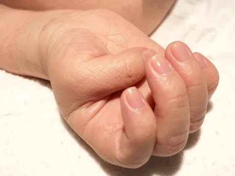 Mano de un bebé cerrada, con el pulgar metido dentro del puño.